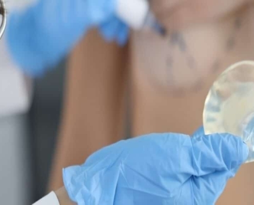 بهترین جراح پروتز سینه در تهران