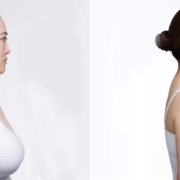 جراحی کوچک کردن سینه زنان